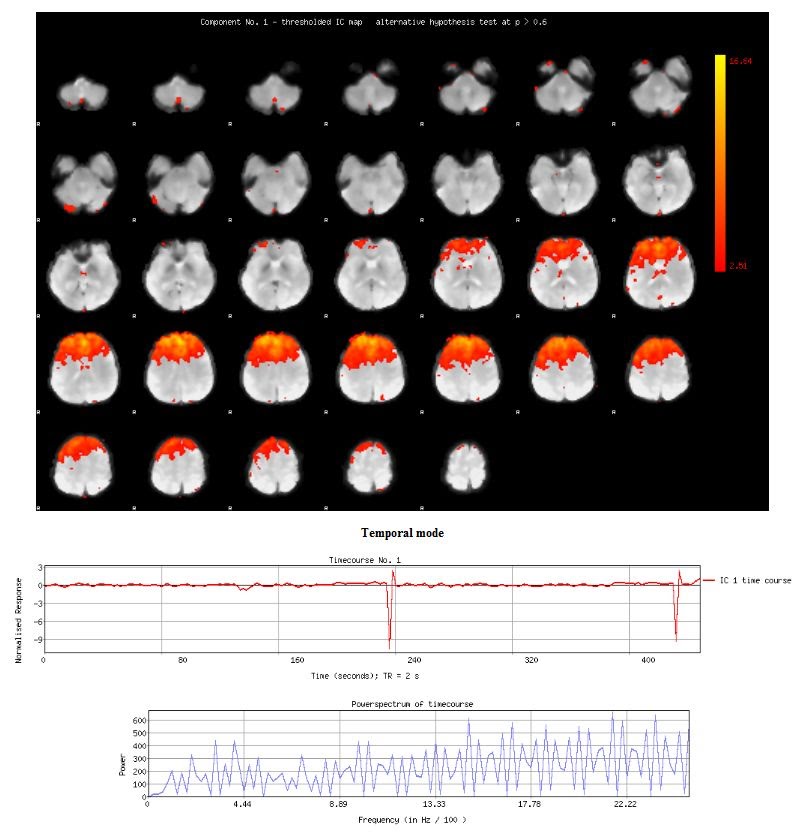 Artifact Analysis Example Artifact: Example 1 - Independent Component Analysis Atlas